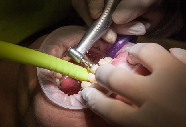 Nagy rá az esély, hogy a jövőben ne csak a fogorvos javíthassa meg a fogainkat?