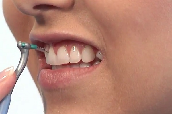 A fogköztisztító kefe is igen hasznos