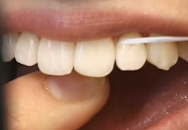 A fogselymezésnek számos előnye van a fogak ápolása szempontjából