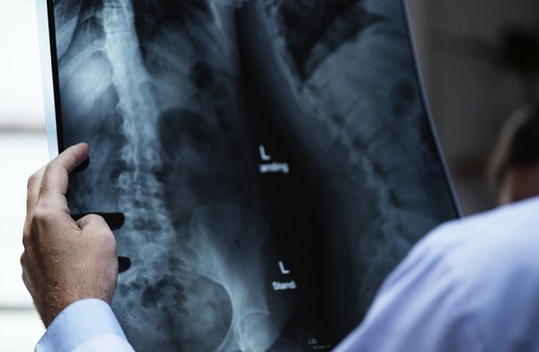 A mesters&eacute;ges intelligencia megmondja, mikor hal meg egy beteg