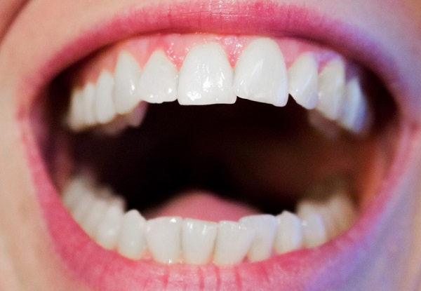 A fogak dentinjének őrzője a szőlőmag-kivonat