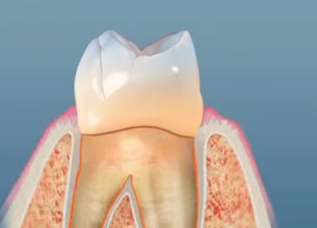 A fogak maguktól újranőhetnek egy Alzheimer-gyógyszernek köszönhetően 