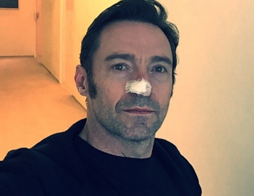 Hugh Jackman újra bőrrák miatt kap kezelést