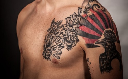 „Már bánom!” - Tetoválások plasztikai eltávolítása