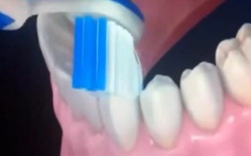 Ez a legjobb megelőzés fogfájás esetén!
