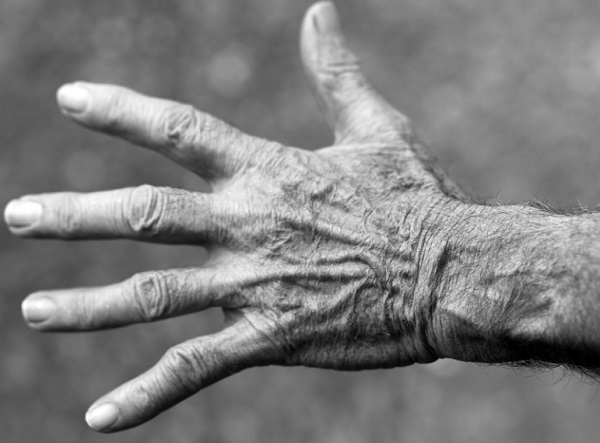 50 év felett szinte kötelező a csontsűrűség-vizsgálat