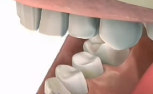 Fontos a D-vitamin a sikeres fogimplantáláshoz
