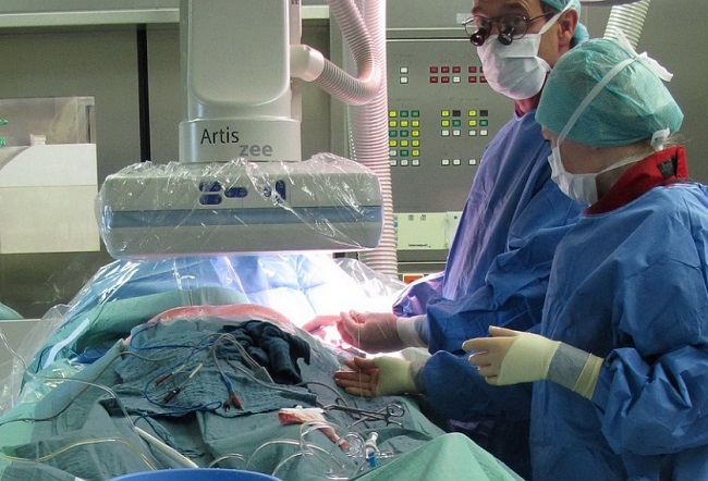Az egynapos sebészeti beavatkozás alkalmával az orvos műtét közben is módosíthat technikát