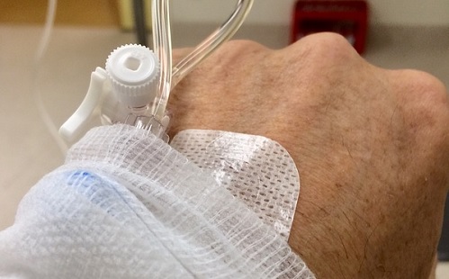 Lényegesen gyorsabban állít fel rák-kezelési tervet az MI