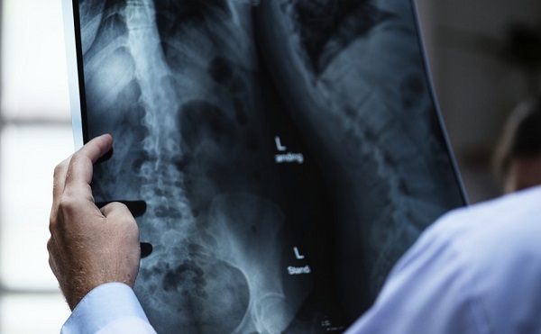 A mesters&eacute;ges intelligencia seg&iacute;ts&eacute;g&eacute;vel j&oacute;val pontosabban lehet azonos&iacute;tani a tumort