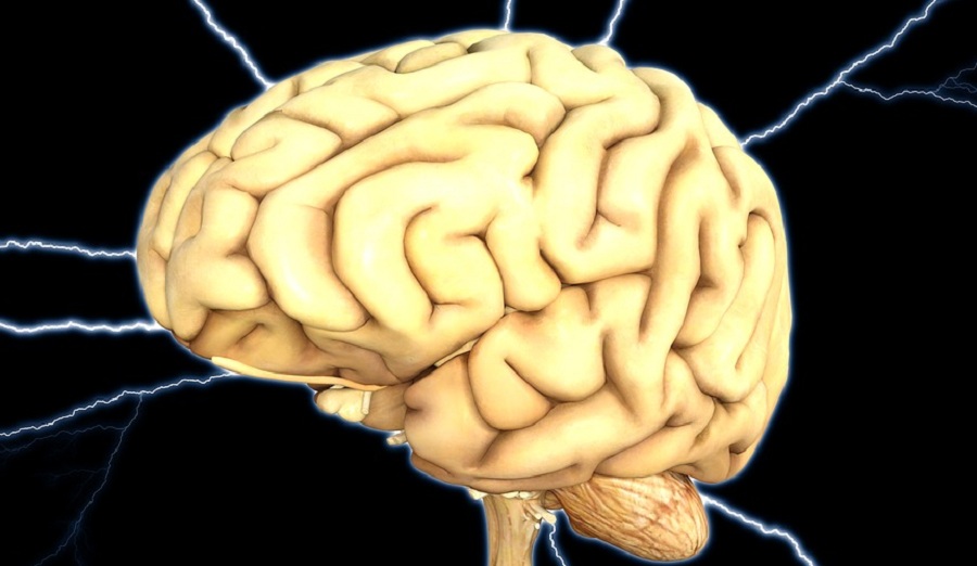 Gyorsan és hatékonyan diagnosztizál agyvérzést a mesterséges intelligencia