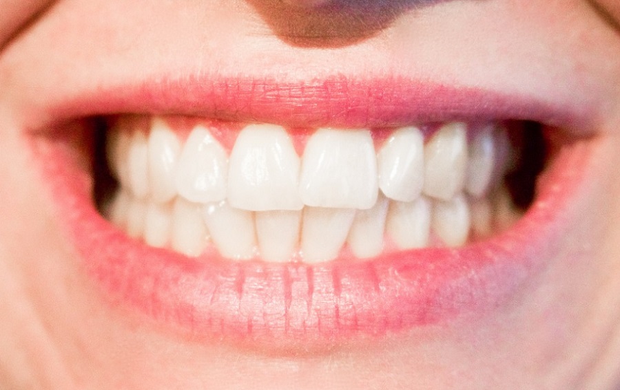 A fogak megfelelő ápolása érdekében a fogmosásra és az étrendre sem árt odafigyelni 