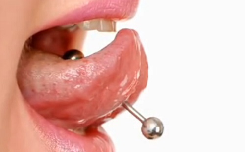 Szájpiercing: miért rossz a fogak szempontjából? – 1.rész