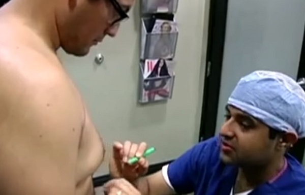 A sebész bejelöli, hogyan kell majd átalakítani a melleket a gynecomastia során