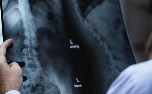 Személyre szabottabb kezelést tesz lehetővé a mesterséges intelligencia