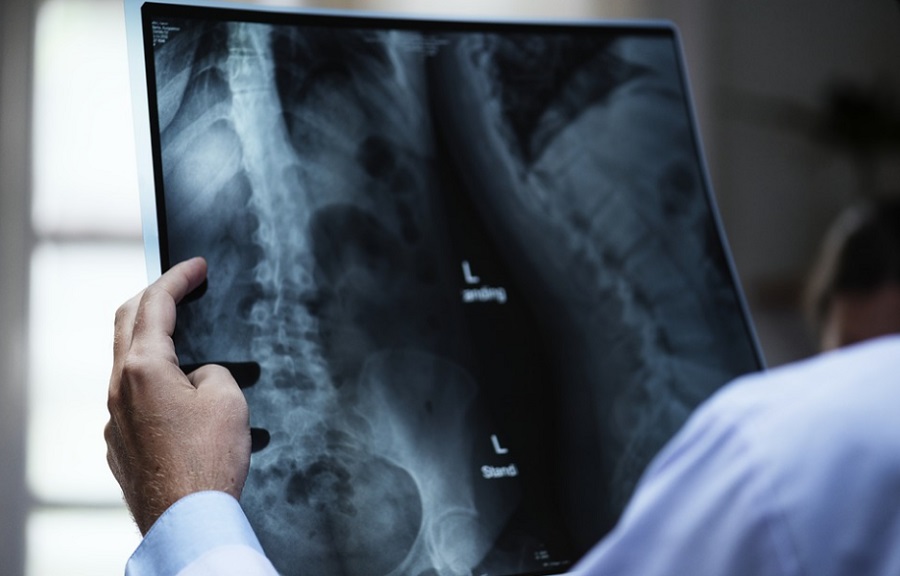 A mesters&eacute;ges intelligencia seg&iacute;ts&eacute;g&eacute;vel a diagn&oacute;zis &eacute;s a kezel&eacute;s is gyorsabb lesz