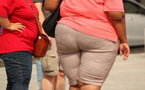 Sokk: az elhízás növeli a nők vastagbélrák esélyét?