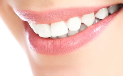 Miből áll egy fogimplantátum? 