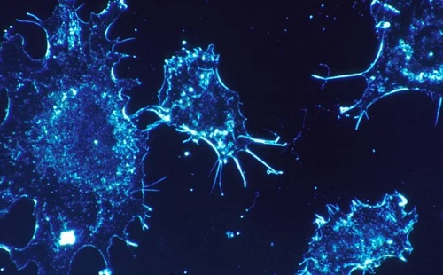 Vérrákot diagnosztizálhat a mesterséges intelligencia