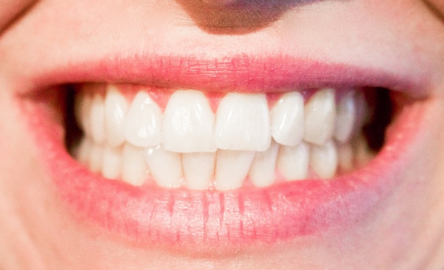 A stressz számos módon befolyásolja a fogak és a száj egészségét is