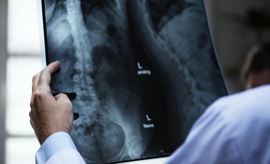 A mesterséges intelligencia jelentősen csökkenti a röntgenfelvétel kiértékelését