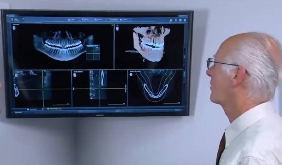 Ma már lehetőség van az implantátumok precíz megtervezésére is