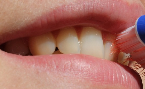 Szájöblítő érzékeny fogakra – milyet érdemes használni?