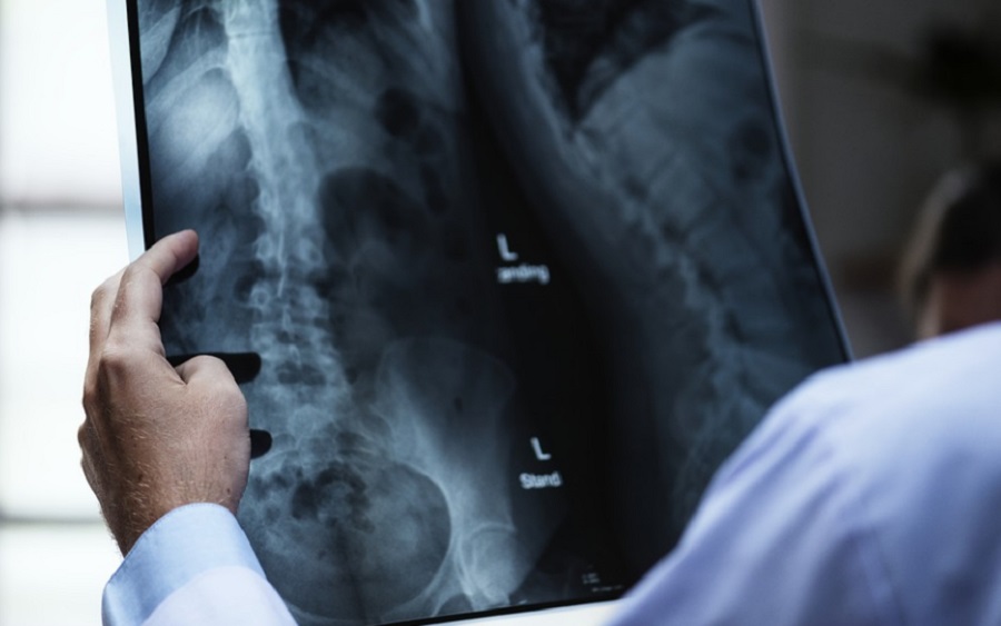 Túlteljesítette a doktorokat a mesterséges intelligencia a röntgenfelvétel-elemzésben