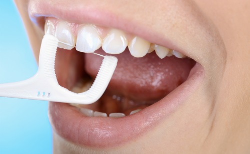 A szájban található lepedéknek 30% a fogközökben található.