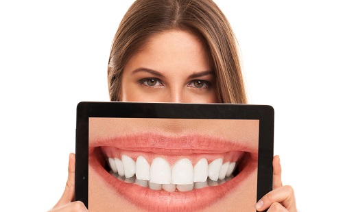 A nők fogászati egészségműveltségi szintje magasabb.