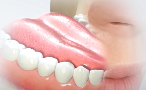 Így könnyíti a fogimplantációt a mesterséges intelligencia