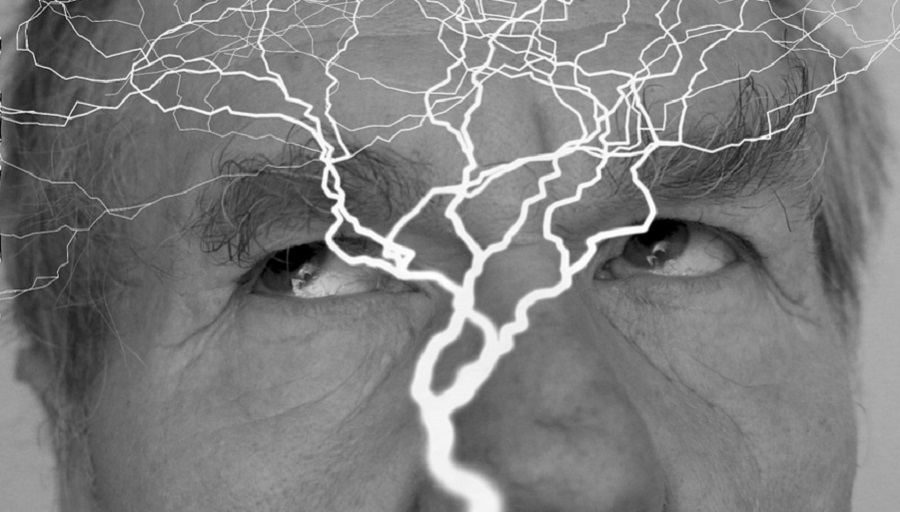 Mesterséges intelligencia segít az epilepsziás roham előrejelzésében