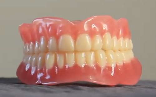 Hogyan forradalmasítja a 3D-nyomtatás a fogászati ipart?