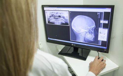 A röntgensugárzás lényege. Mi a röntgen és hogyan használják az orvostudományban