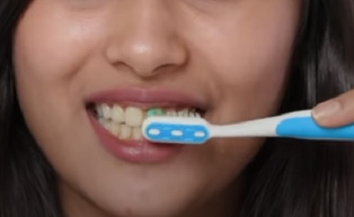 Károsak a fogfehérítő termékek a fogsejtekre?