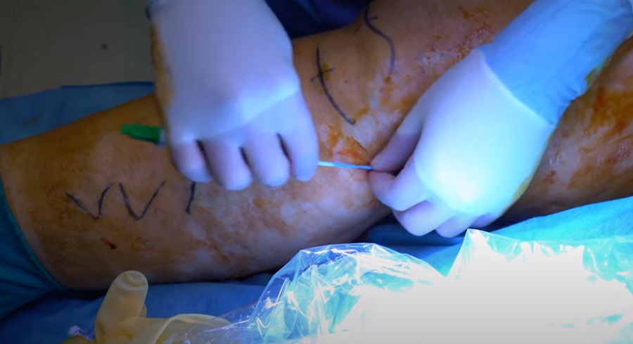 Az érsebész magasan képzett és a műtétek széles skálájának elvégzésére képes