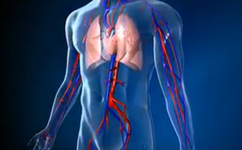 Perifériás artéria bypass és arteria carotis - Az érsebészet főbb típusai 1.