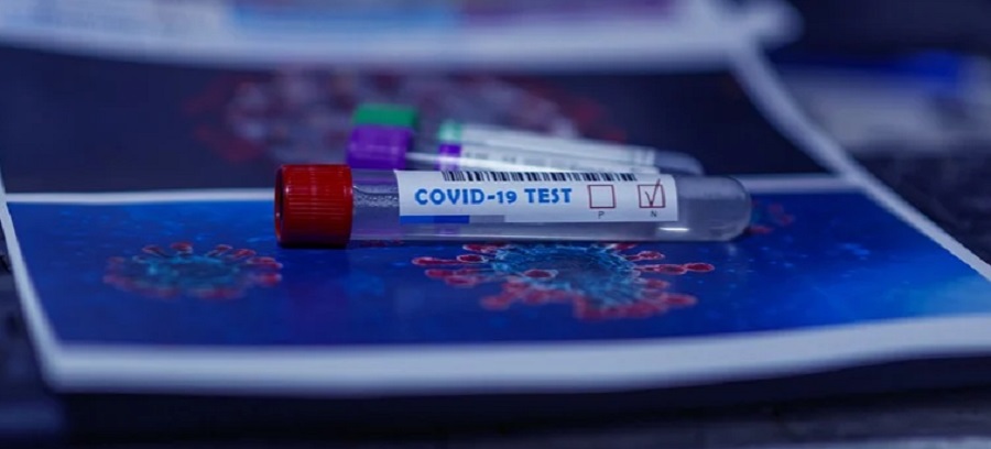 Alig egy óra alatt kimutatható a koronavírus egy új eszközzel