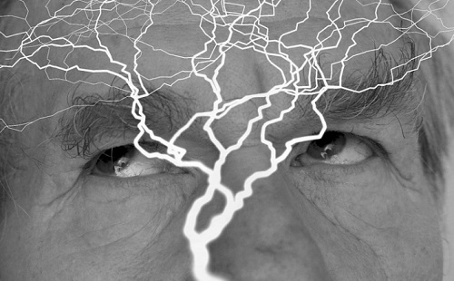 Epilepsziás rohamot jelezhet előre a mesterséges intelligencia