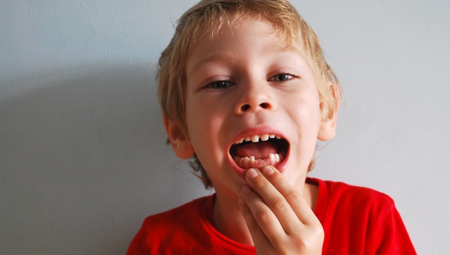 A fogak növekedési vastagsága segíthet azonosítani azokat a gyermekeket, akiknél később fennállhat mentális zavar
