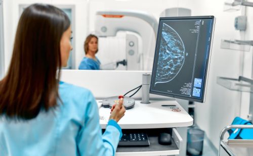 Mesterséges intelligencia segít a mammográfiás vizsgálatok elemzésében
