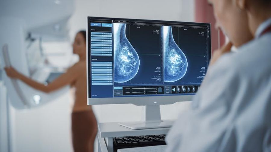 A mellrák kialakulásának kockázatát csökkentheti a mesterséges intelligencia