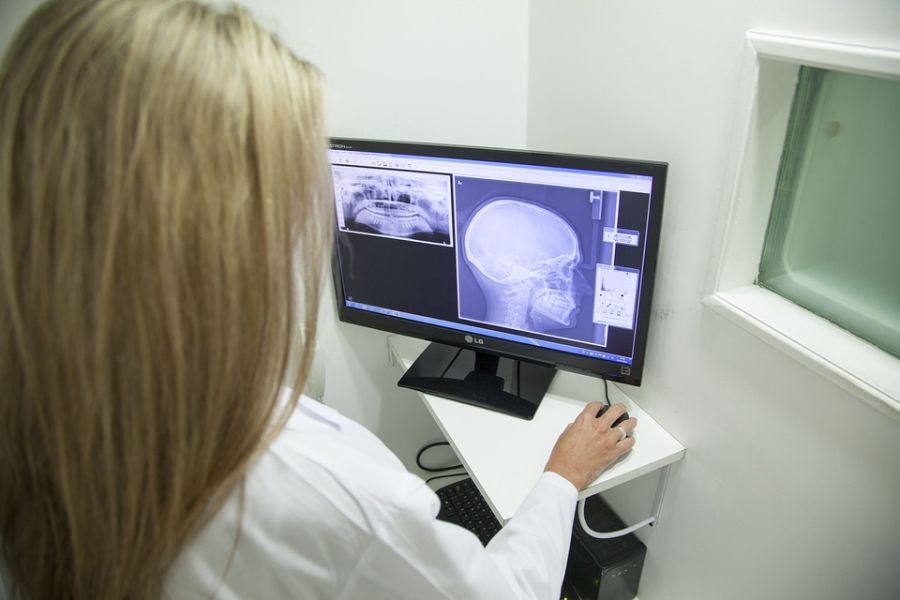 Hatékonyabbá teheti a röntgenfelvételek elemzését a mesterséges intelligencia