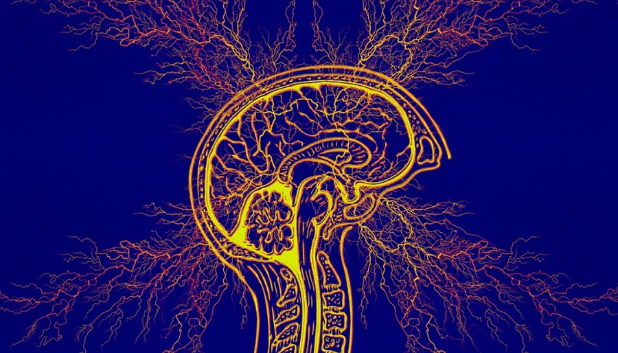 Epilepszia – MRI-n se látható rendellenességet észlel a mesterséges intelligencia