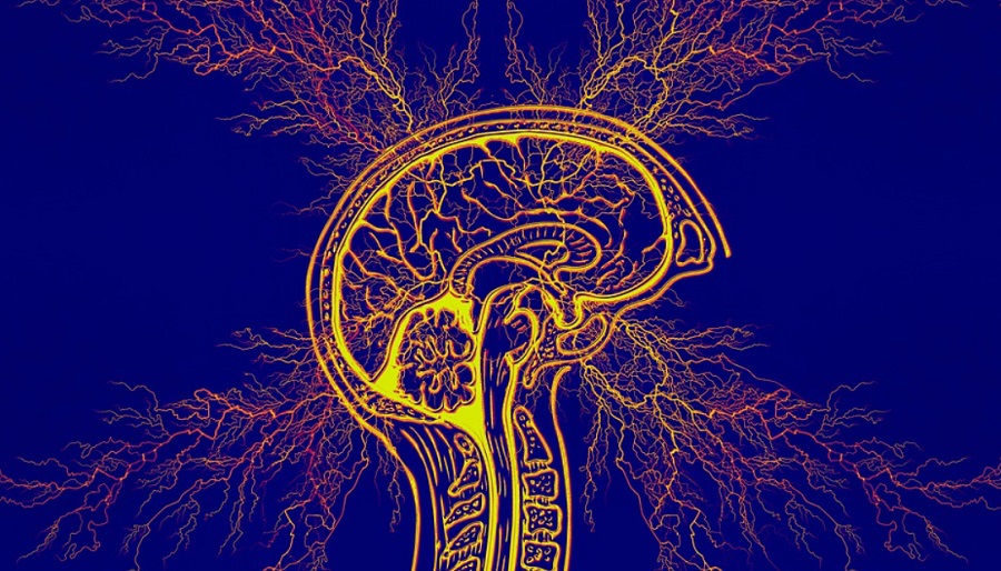 Epilepszia – MRI-n se látható rendellenességet észlel a mesterséges intelligencia