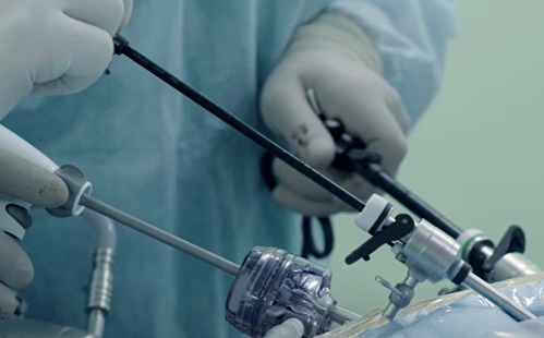 Mesterséges intelligencia - Teljesen egyedül végzett egy robot laparoszkópos műtétet