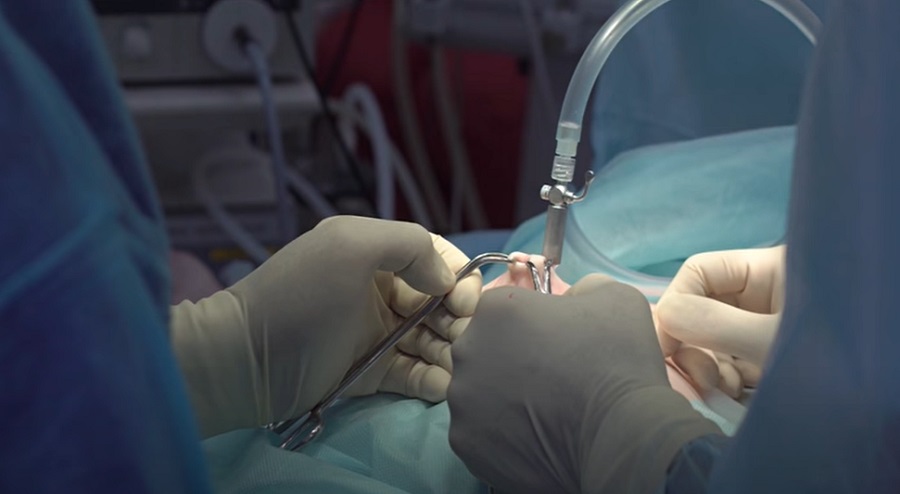 Laparoszkópos műtét ember sebészekkel