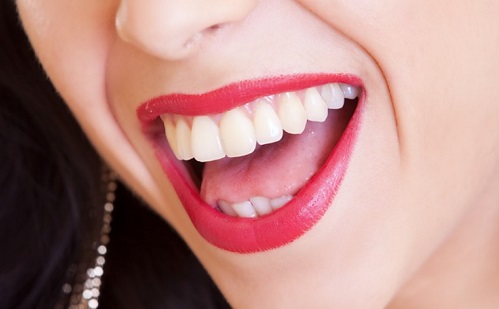 Plusz 5 tipp, hogy egészségesebbnek tűnjenek a fogaink
