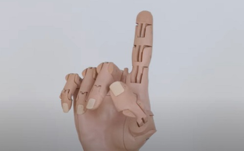 Technológia - 3D szkennelést használ a végtagprotézis