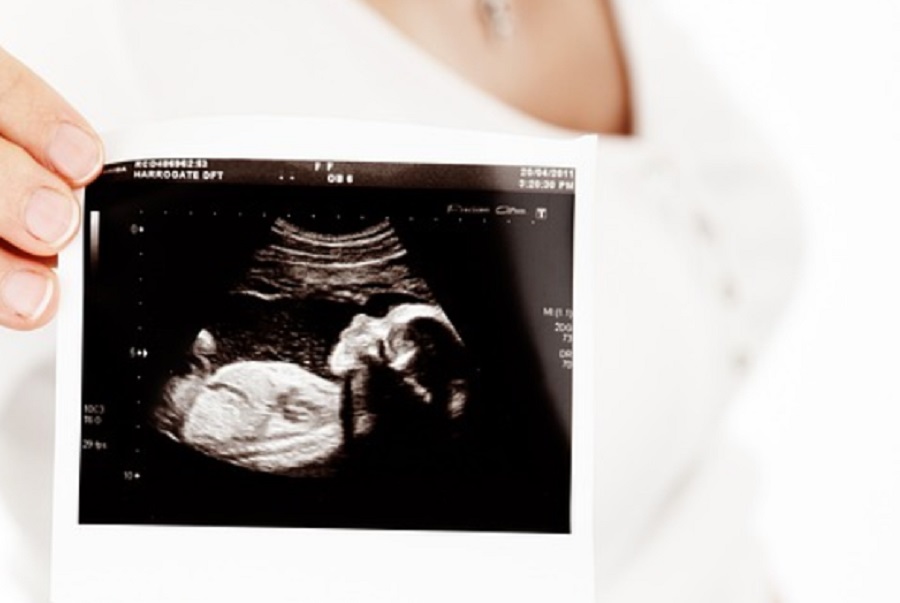 Születési rendellenességet is azonosíthat a mesterséges intelligencia ultrahangos képeken